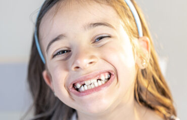 Pediatric Dental Treatment (Children’s Dentistry)