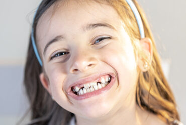 Pediatric Dental Treatment (Children’s Dentistry)