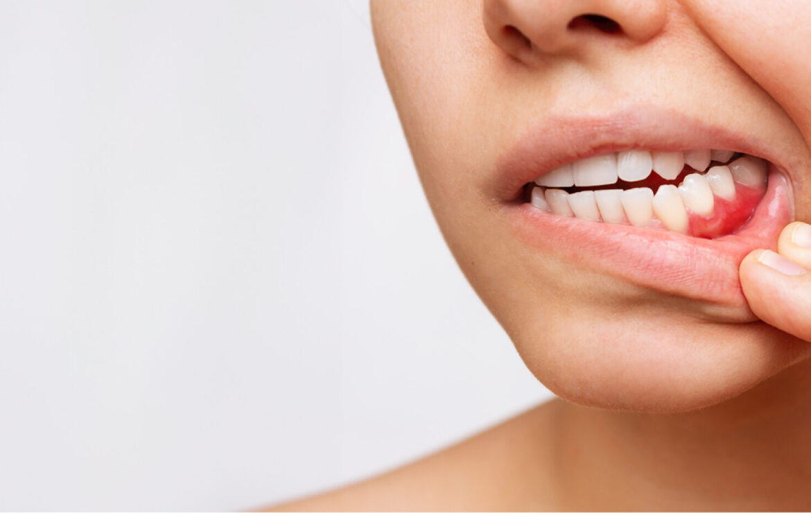 Top 10 Common Dental Problems and How to Prevent Them