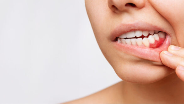 Top 10 Common Dental Problems and How to Prevent Them