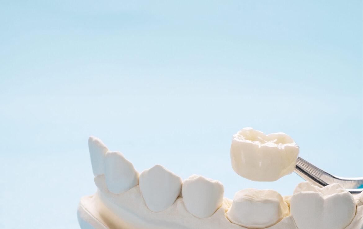 Dental Implant Cost in Mumbai: A Complete Guide for 2026 – NR Dental Clinic Mumbai