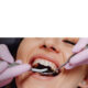 Top Myths & Facts About Dental Implants: What NR Dental Clinic Patients Should Know
