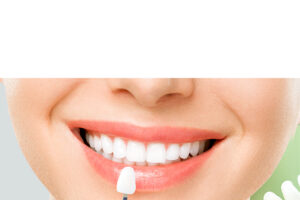 Teeth Whitening in Mumbai: Safe, Professional & Long-Lasting Results at NR Dental Clinic