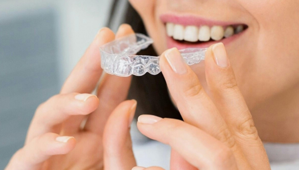 Invisalign Orthodontic Treatment Cost: What You Need to Know