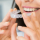 Invisalign Orthodontic Treatment Cost: What You Need to Know