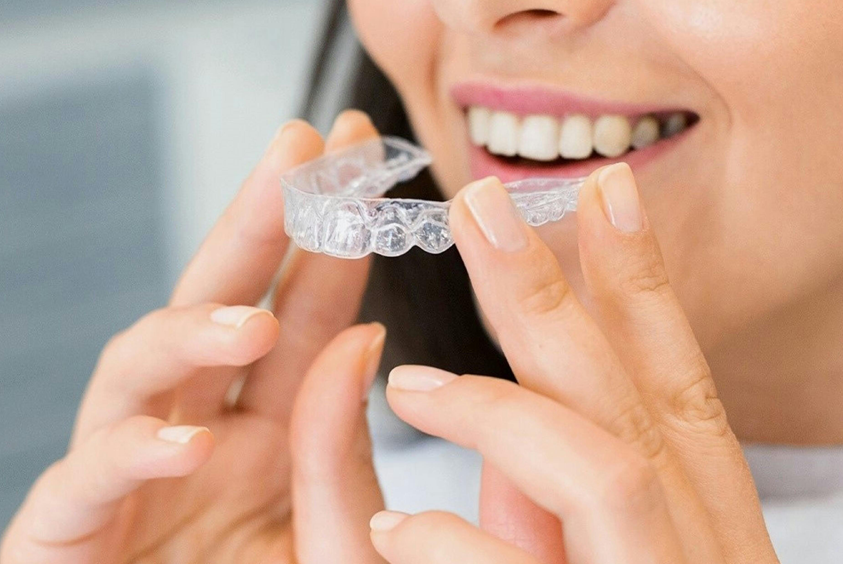 Invisalign Orthodontic Treatment Cost: What You Need to Know