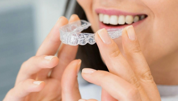 Invisible Braces: Perfect Teeth Straightener