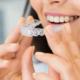 Invisible Braces: Perfect Teeth Straightener