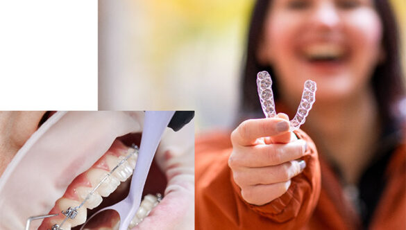 Dental Hygiene & Prevention