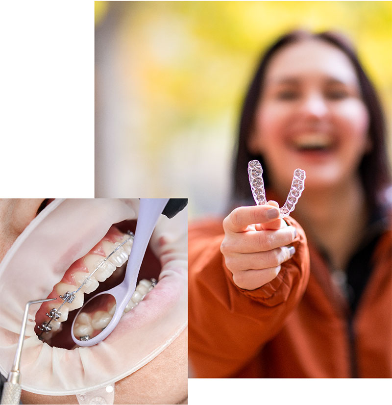 Dental Hygiene & Prevention